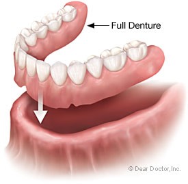 full denture one