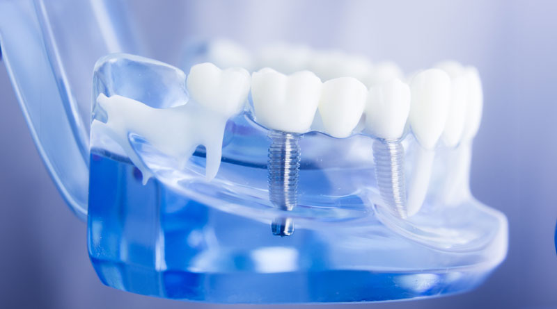 About Us Steadman Family Dentistry Richmond