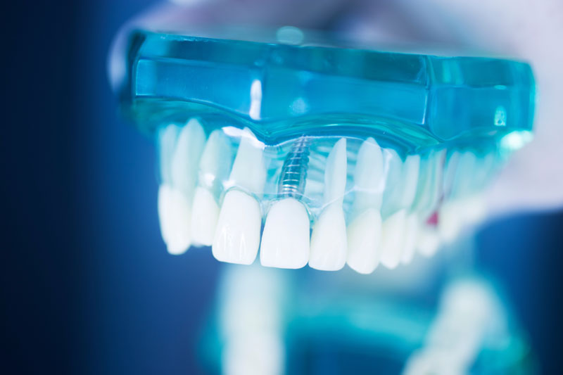 About Us Steadman Family Dentistry Richmond