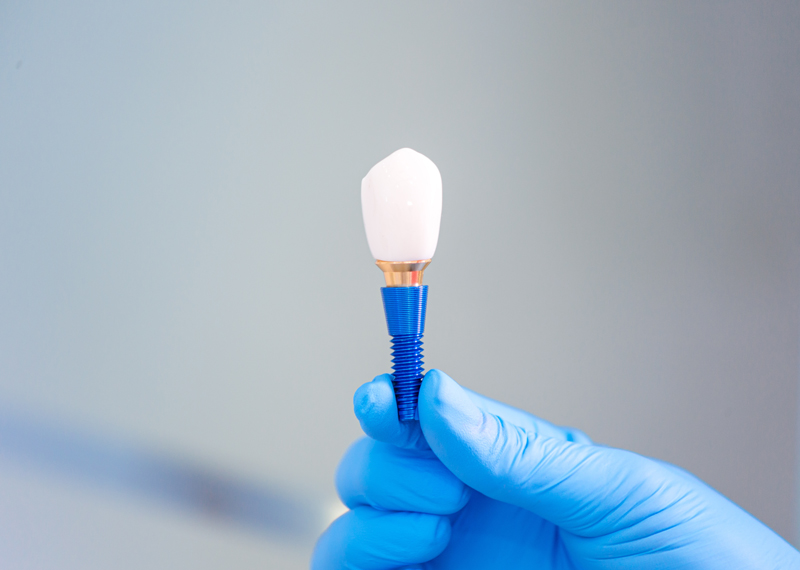 About Us Steadman Family Dentistry Richmond