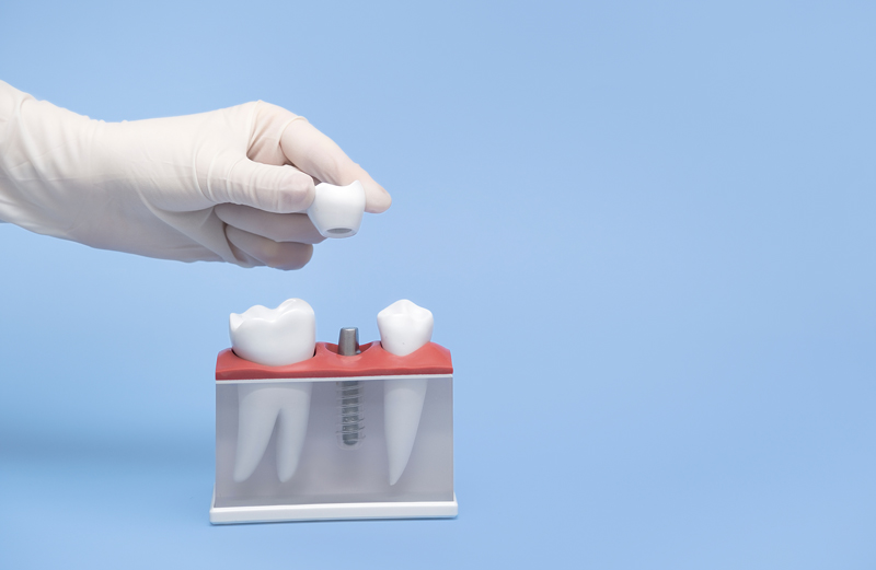About Us Steadman Family Dentistry Richmond