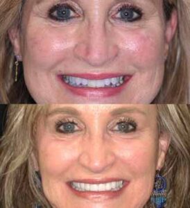 terri snelling - Cosmetic Before & After - 02