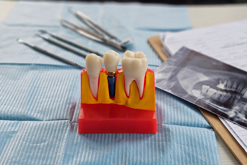 About Us Steadman Family Dentistry Richmond