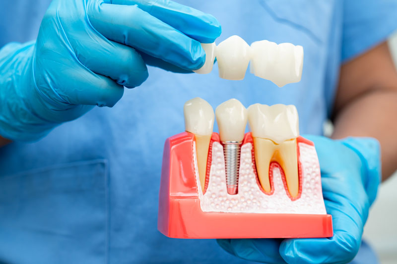 About Us Steadman Family Dentistry Richmond